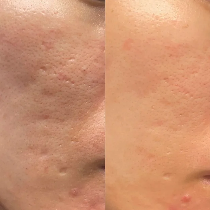 Professionell hudvård hos Skandi Beauty på Värmdö